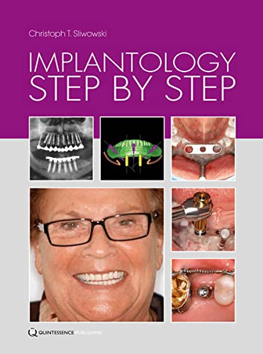 

dental-sciences/dentistry/implantology-step-by-step-9781850972815