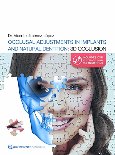 

dental-sciences/dentistry/occlusal-adjustments-in-implants-and-natural-dentition-3d-occlusion-tmj-patho-related-to-occlusion-9781850972921