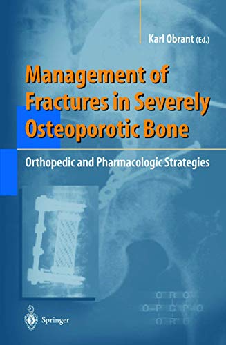 

general-books/general/management-of-fractures-in-severely-osteoporotic-bone-orthopedic-and-pharmacologic-strategies-dm-348--9781852332204