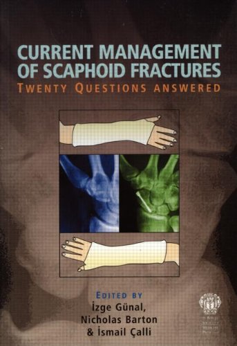 

mbbs/4-year/current-management-of-scaphoid-fractures-20-questions-answered-9781853155185