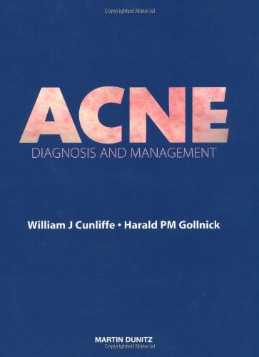 

general-books/general/acne-diagnosis-and-management--9781853172069