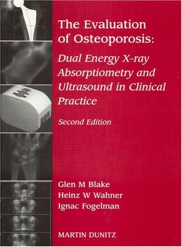 

mbbs/4-year/the-evaluation-of-osteoporosis-2ed-9781853174728