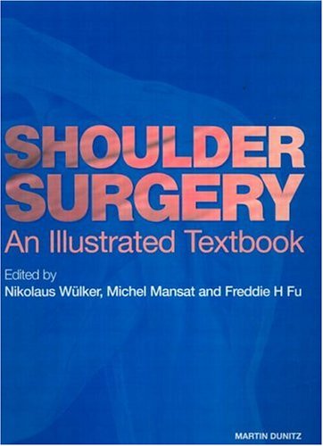

special-offer/special-offer/shoulder-surgery-an-illustrated-textbook--9781853175633