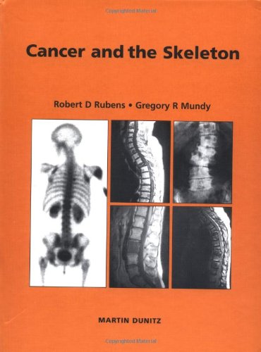 

mbbs/4-year/cancer-and-the-skeleton-9781853177569