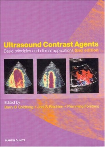 

special-offer/special-offer/ultrasound-contrast-agents-basic-principles-and-clinical-applications--9781853178283