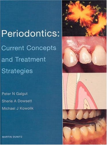 

general-books/general/periodontics-current-concepts-and-treatment-strategies--9781853179815