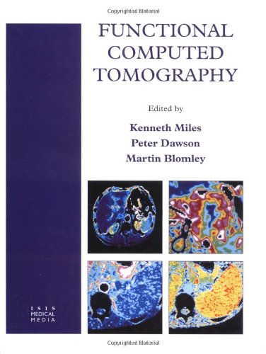 

special-offer/special-offer/functional-computed-tomography--9781899066391