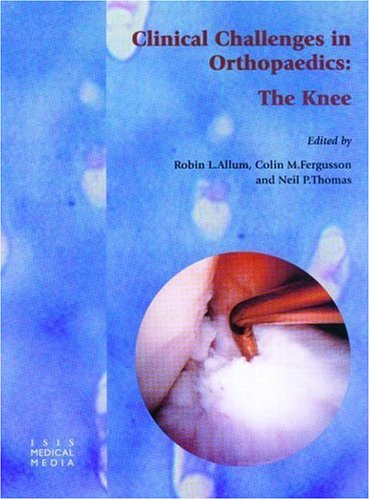 

special-offer/special-offer/clinical-challenges-in-orthopaedics-the-knee--9781899066636