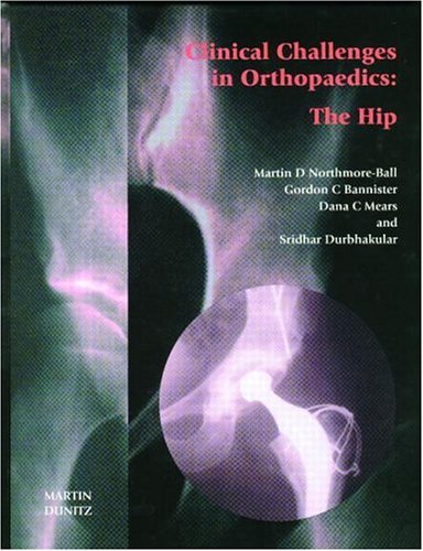 

general-books/general/clinical-challenges-in-orthopaedics-the-hip--9781899066834