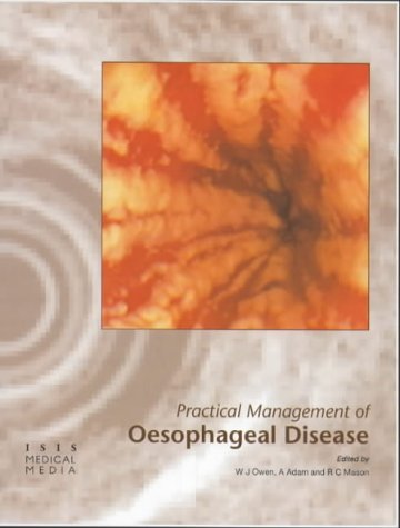 

special-offer/special-offer/practical-management-of-oesophageal-disease--9781899066940