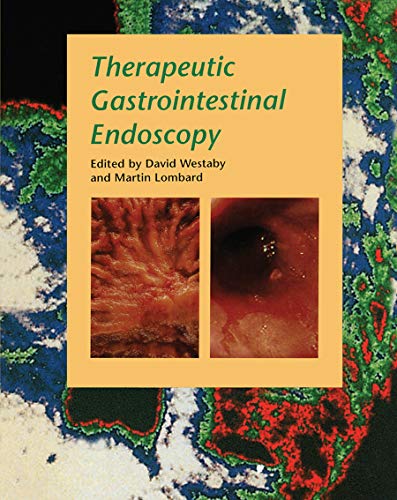 

general-books/general/therapeutic-gastrointestinal-endoscopy-1-ed--9781899066957
