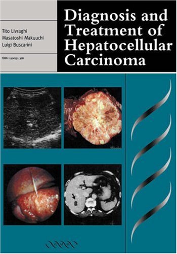 

clinical-sciences/gastroenterology/diagnosis-and-treatment-of-hepatocellular-carcinoma-9781900151306