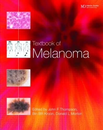 

special-offer/special-offer/textbook-of-melanoma--9781901865653
