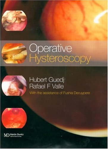 

special-offer/special-offer/operative-hysteroscopy--9781901865677