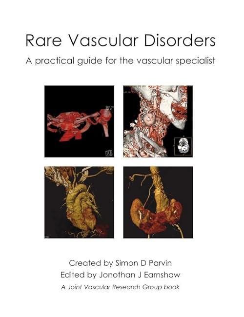 

surgical-sciences/cardiac-surgery/rare-vascular-disorders-a-practical-guide-for-the-vascular-specialist-9781903378328