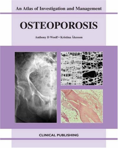 

surgical-sciences/orthopedics/osteoporosis-an-atlas-of-investigation-and-diagnosis-9781904392262