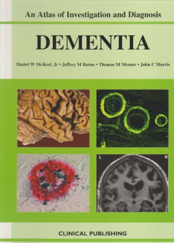 

surgical-sciences/nephrology/an-atlas-of-investigation-and-diagnosis-dementia-9781904392378
