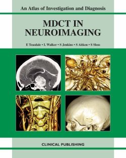 

mbbs/4-year/an-atlas-and-practical-guide-multidetector-ct-in-neuroimaging-9781904392682