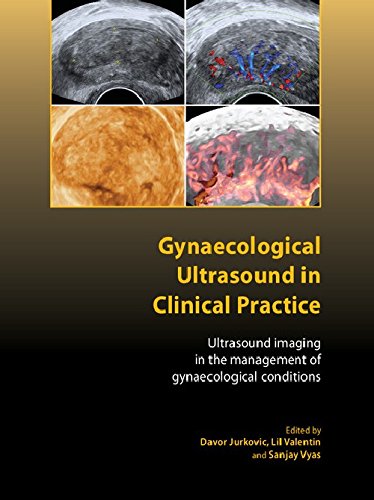 

general-books/general/gynaecological-ultrasound-in-clinical-practice-1-ed--9781904752295