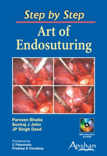 

special-offer/special-offer/step-by-step-art-of-endosuturing--9781904798828