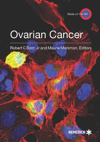 

mbbs/4-year/ovarian-cancer-9781905721535
