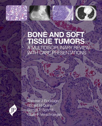 best-sellers/jaypee-brothers-medical-publishers/bone-and-soft-tissue-tumors-a-multidisciplinary-review-with-case-presentations-9781907816222