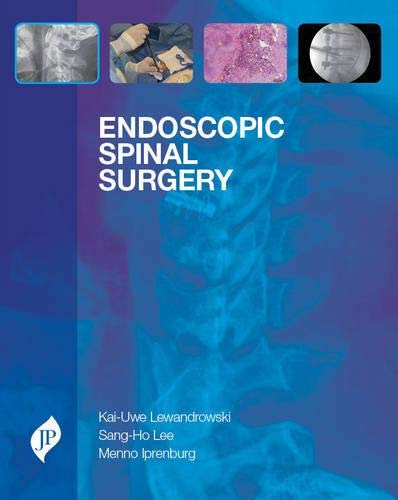 

best-sellers/jaypee-brothers-medical-publishers/endoscopic-spinal-surgery-9781907816277