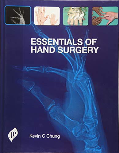 

best-sellers/jaypee-brothers-medical-publishers/essentials-of-hand-surgery-9781907816321