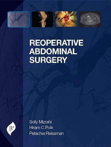 

best-sellers/jaypee-brothers-medical-publishers/reoperative-abdominal-surgery-9781907816550