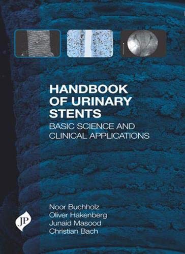 

best-sellers/jaypee-brothers-medical-publishers/handbook-of-urinary-stents-basic-science-and-clinical-applications-9781907816659