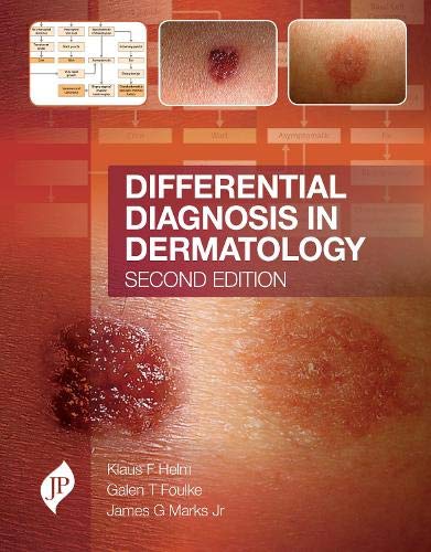 

best-sellers/jaypee-brothers-medical-publishers/differential-diagnosis-in-dermatology-9781909836198