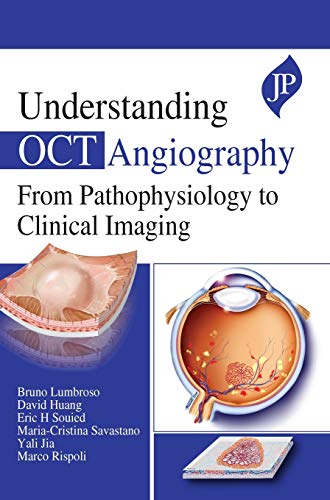 

best-sellers/jaypee-brothers-medical-publishers/understanding-oct-angiography-from-pathophysiology-to-clinical-imaging-9781909836938
