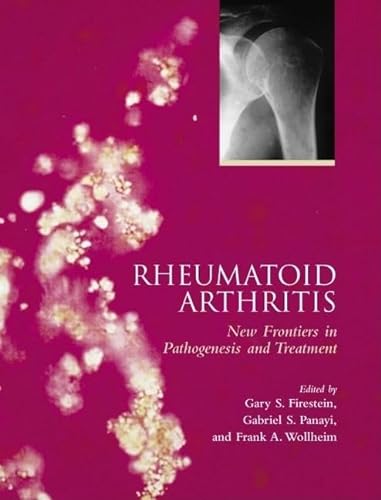 

special-offer/special-offer/rheumatoid-arthritis-frontiers-in-pathogenesis-and-treatment--9780192629722