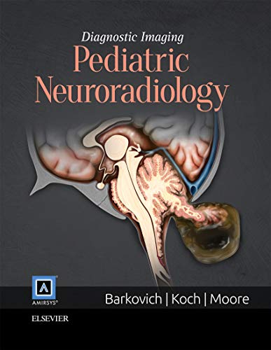 

surgical-sciences/nephrology/diagnostic-imaging-pediatric-neuroradiology-2e--9781931884853