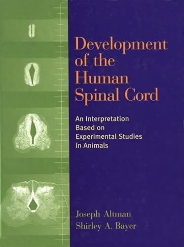 

special-offer/special-offer/development-of-the-human-spinal-cord--9780195144277