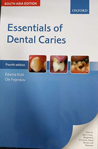 

exclusive-publishers/oxford-university-press/essentials-of-dental-caries-9780198802334