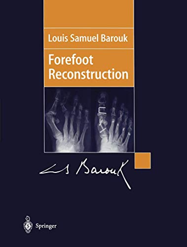 

general-books/general/forefoot-reconstruction--9782287596568