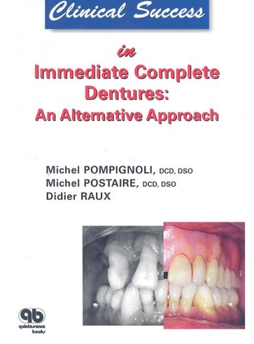 

dental-sciences/dentistry/clinical-success-in-immediate-complete-dentures-an-alternative-approach-9782912550576
