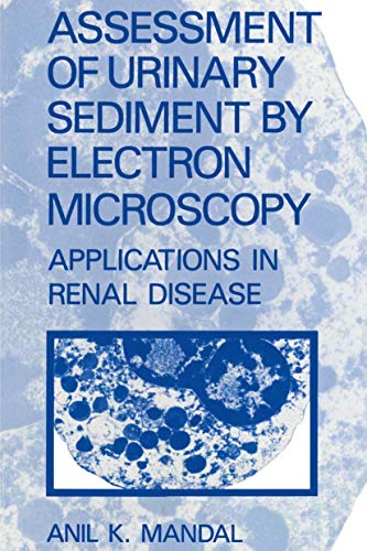 

special-offer/special-offer/assessment-of-urinary-sediment-by-electron-microscopy-applications-in-ren--9780306425219