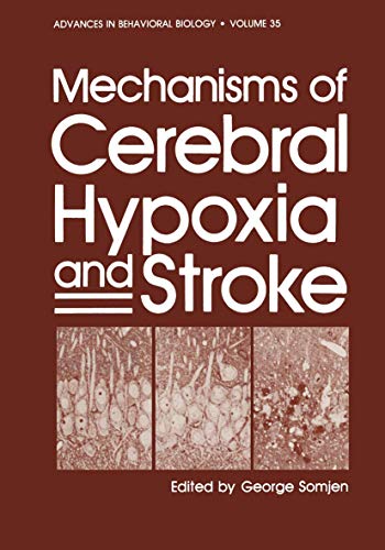 

special-offer/special-offer/mechanisms-of-cerebral-hypoxia-and-stroke--9780306430152