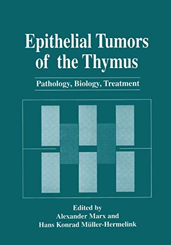 

special-offer/special-offer/epithelial-tumors-of-the-thymus--9780306455919