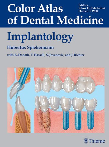 

general-books/general/color-atlas-of-dental-medicine-implantology-9783131002310