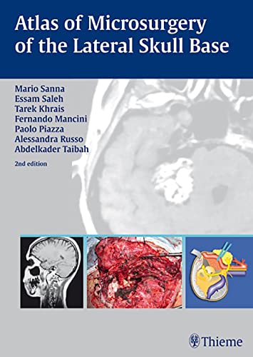 

exclusive-publishers/thieme-medical-publishers/atlas-of-microsurgery-of-the-lateral-skull-base-2-e--9783131010926