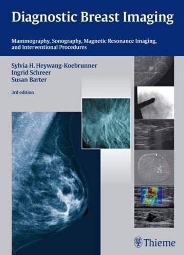 DIAGNOSTIC BREAST IMAGING: MAMMOGRAPHY, SONOGRAPHY, MRI AND INTERVENTIONAL PROCEDURES