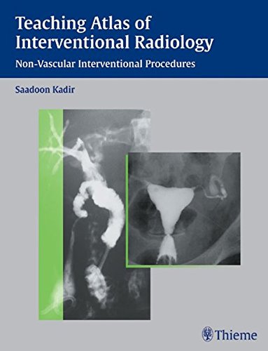 

exclusive-publishers/thieme-medical-publishers/teaching-atlas-of-interventional-radiology--9783131079725