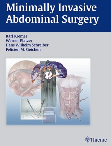 

exclusive-publishers/thieme-medical-publishers/minimally-invasive-abdominal-surgery--9783131081919