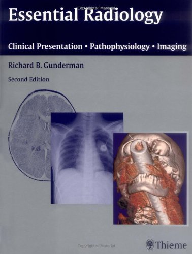 

exclusive-publishers/thieme-medical-publishers/essentials-radiology-clinical-presentation-pathophysiology-imaging-2ed--9783131104724