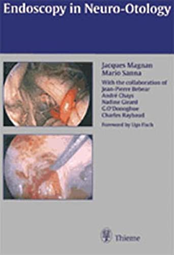 

mbbs/4-year/endoscopy-in-neuro-otology-and-skull-base-surgery-1-e-9783131130617