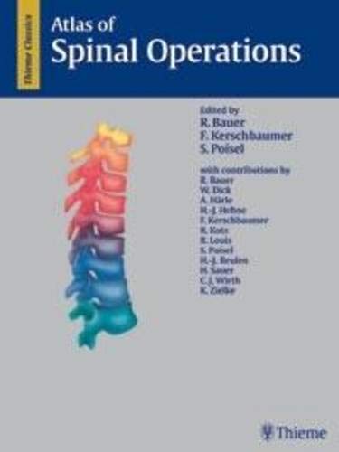 

exclusive-publishers/thieme-medical-publishers/atlas-of-spinal-operations--9783131140012