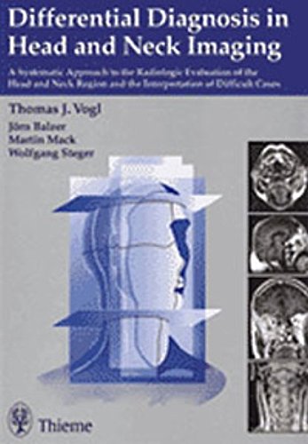 

exclusive-publishers/thieme-medical-publishers/differential-diagnosis-in-head-and-neck-imaging-9783131154118